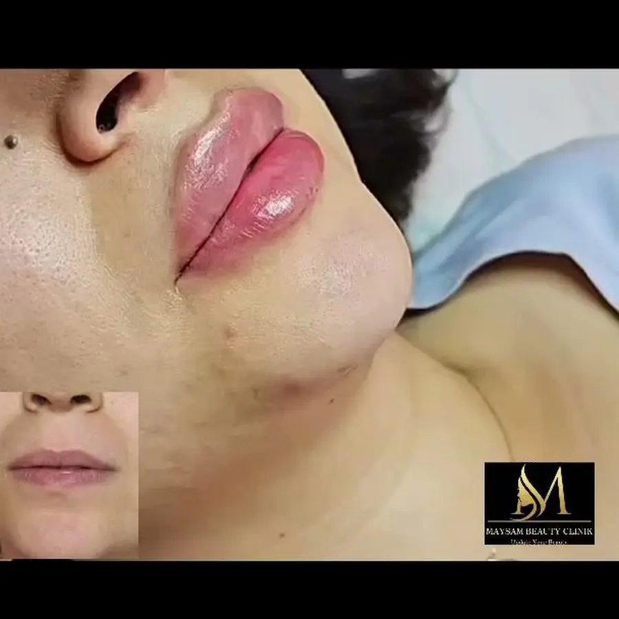 Foto från Maysam Beauty Clinic i Södertälje